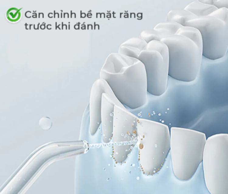 Máy tăm nước Magic Eco PRO-81 (hình 4)