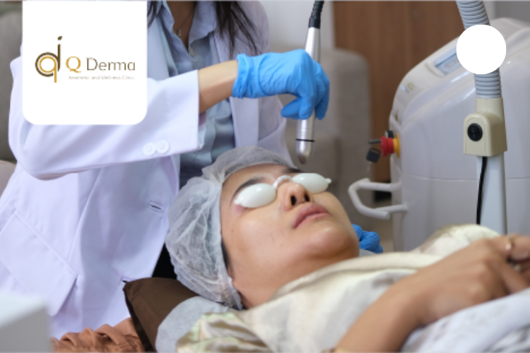 qderma 4