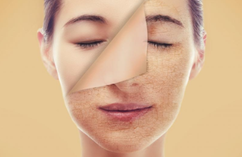 quả sơn trà (hình 7)