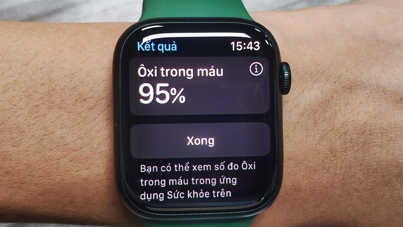 So sánh smartwatch Apple và Samsung 2026 - hình 7