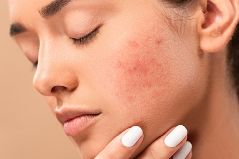 Tinh dầu trầm hương ảnh 6