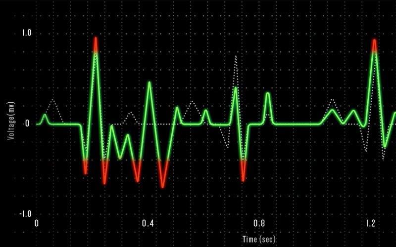cong nghe garmin elevate co uu diem gi