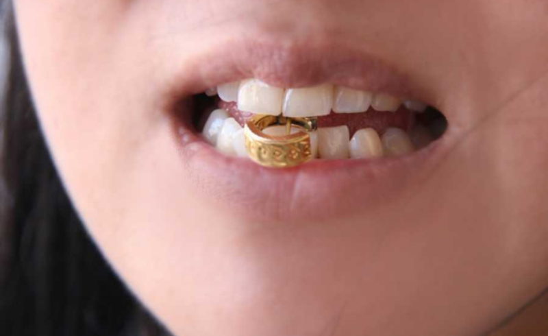 Vàng non là gì? (hình 6)