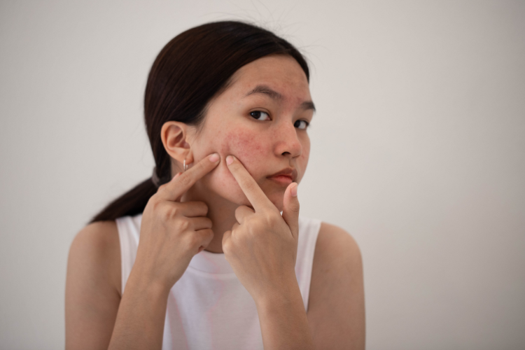 xông mặt bằng lá tía tô hình 3